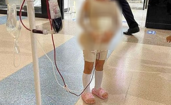 Así o más buchona: niña se pone un disfraz de cirugías estéticas para Halloween