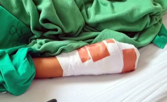 Sin corazón: quema a sus hijitos como castigo ayudada por el padrastro