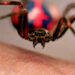 En Bolivia, niño se deja picar por araña viuda negra porque quería ser Spider-Man