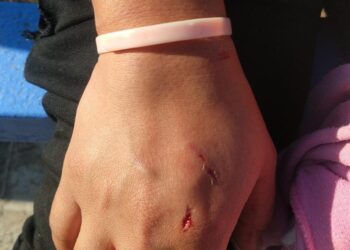 En Reynosa feroces perros atacan  a mujer en la Almendras Sector II