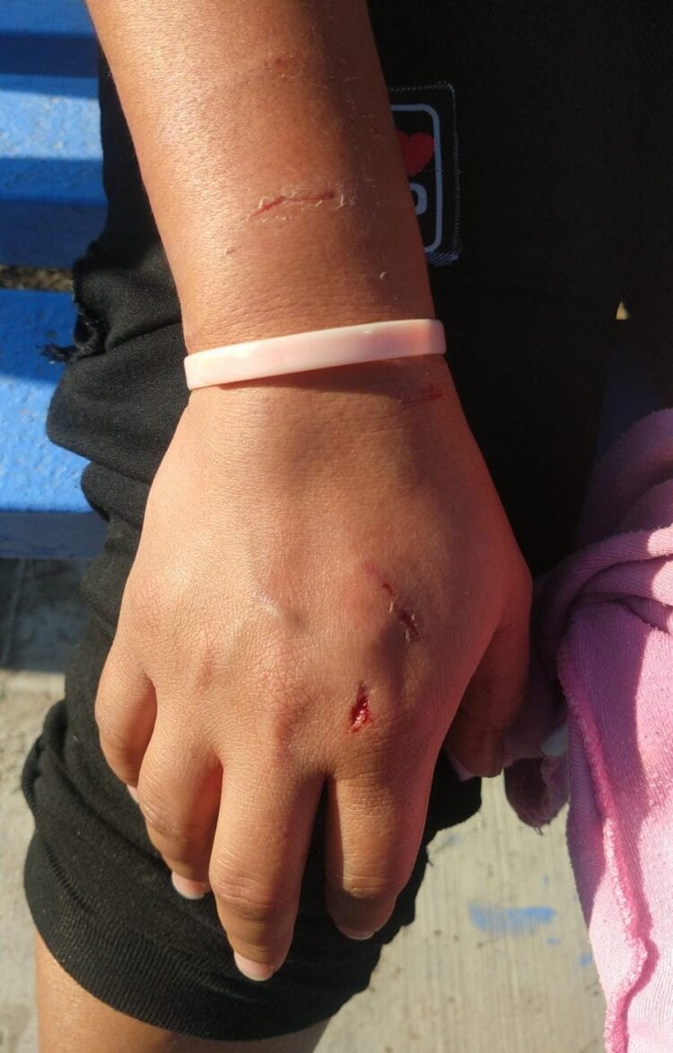 En Reynosa feroces perros atacan a mujer en la Almendras Sector II