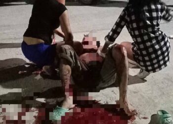 En Altamira: Lo Machetea “El Pelón” por Viejas Rencillas